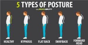 Which Of The 5 Posture Types Are You?
